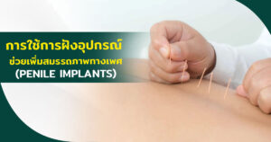 เเกนองคชาต