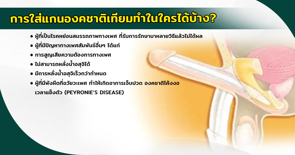 เเกนองคชาต